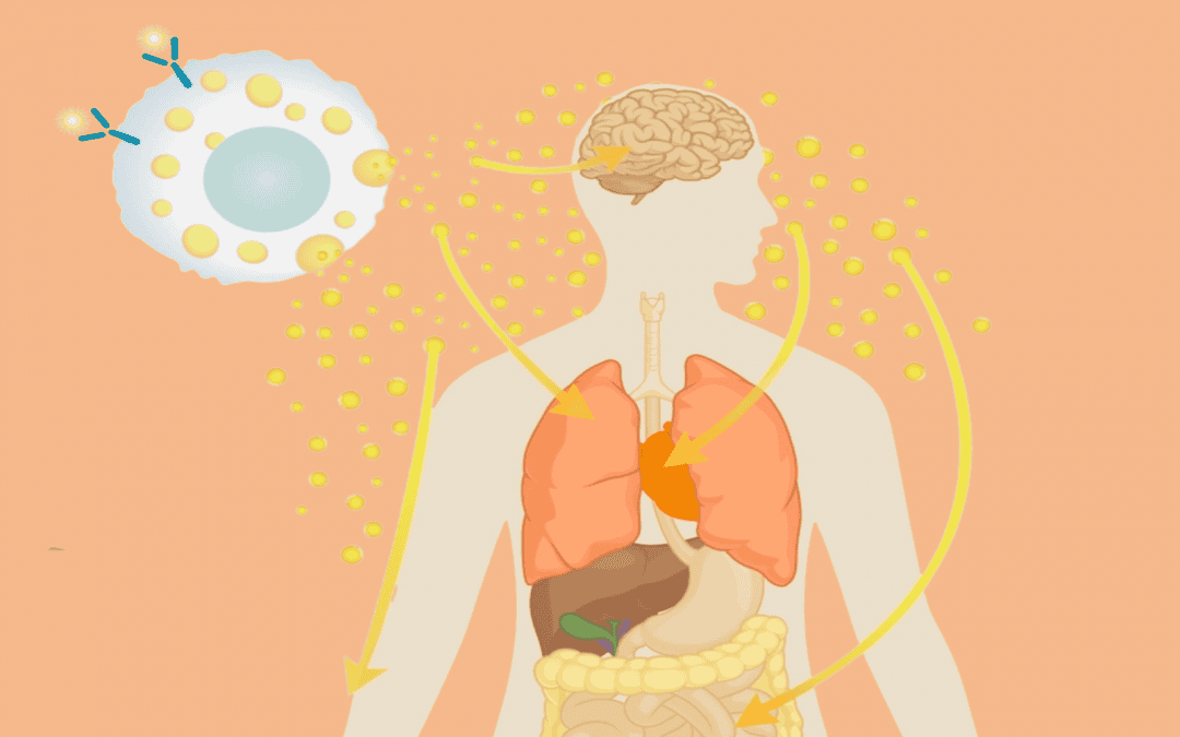 Mast Cell Activation Syndrome: Symptoms, Causes, Treatments, and Natural Approaches