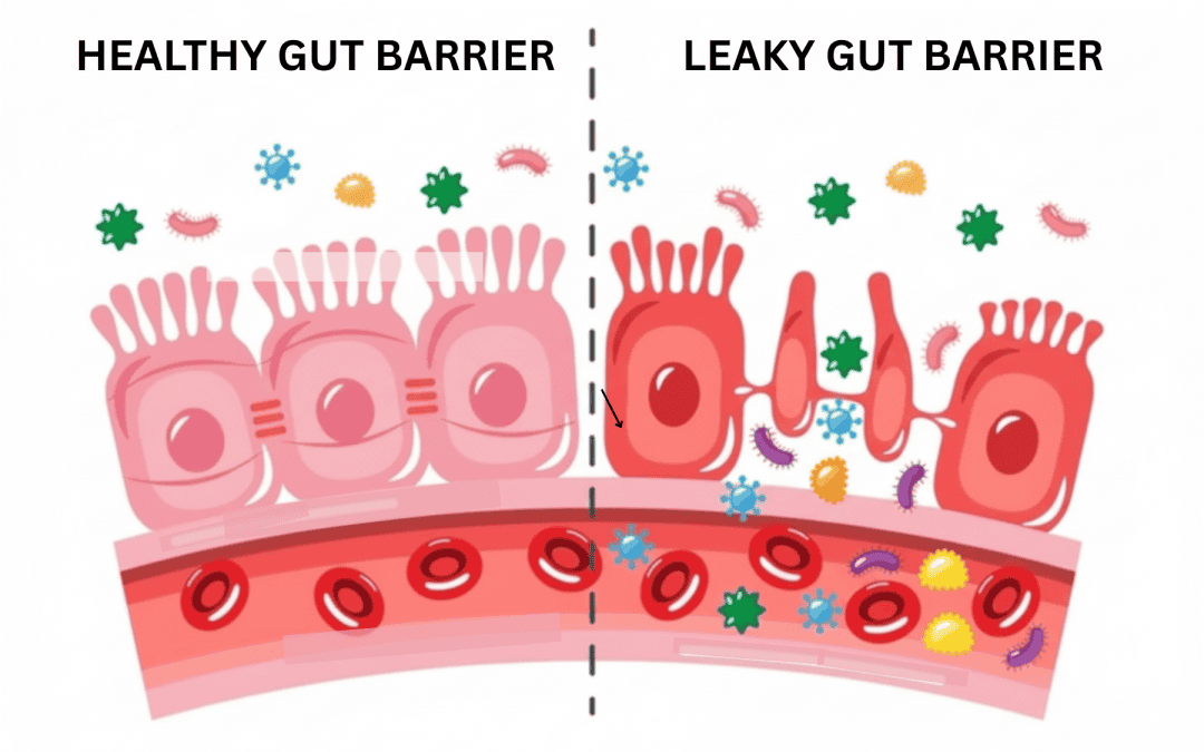 Intestinal Permeability: What Leaky Gut Really Is (and Isn’t)