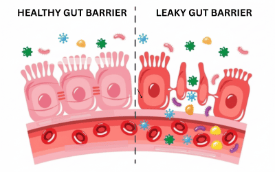 Intestinal Permeability: What Leaky Gut Really Is (and Isn’t)